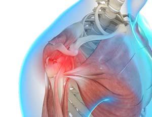  Shoulder Trauma 